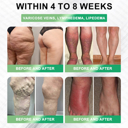 🌱🌱𝑷𝒓𝒆𝒕𝒕𝒚𝒓𝒐𝒔𝒆® 𝐺𝐿𝑃-1 6-𝑖𝑛-1 𝑴𝒆𝒕𝒂𝒃𝒐𝒍𝒊𝒄 𝑹𝒆𝒗𝒊𝒕𝒂𝒍𝒊𝒛𝒊𝒏𝒈 𝐎𝐫𝐚𝐥 𝐒𝐨𝐥𝐮𝐭𝐢𝐨𝐧 | 𝗦𝘂𝗽𝗽𝗼𝗿𝘁𝘀 𝗔𝗽𝗽𝗲𝘁𝗶𝘁𝗲 𝗖𝗼𝗻𝘁𝗿𝗼𝗹 · 𝗕𝗼𝗼𝘀𝘁𝘀 𝗠𝗲𝘁𝗮𝗯𝗼𝗹𝗶𝘀𝗺 · 𝗥𝗲𝗱𝘂𝗰𝗲𝘀 𝗕𝗹𝗼𝗮𝘁𝗶𝗻𝗴 & 𝗪𝗮𝘁𝗲𝗿 𝗥𝗲𝘁𝗲𝗻𝘁𝗶𝗼𝗻